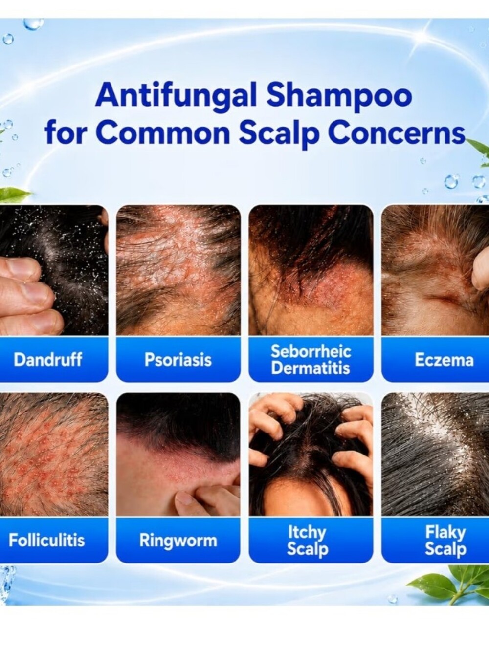 Anti-Fungal Anti-Dandruff Shampoo - Picture 2 of 11